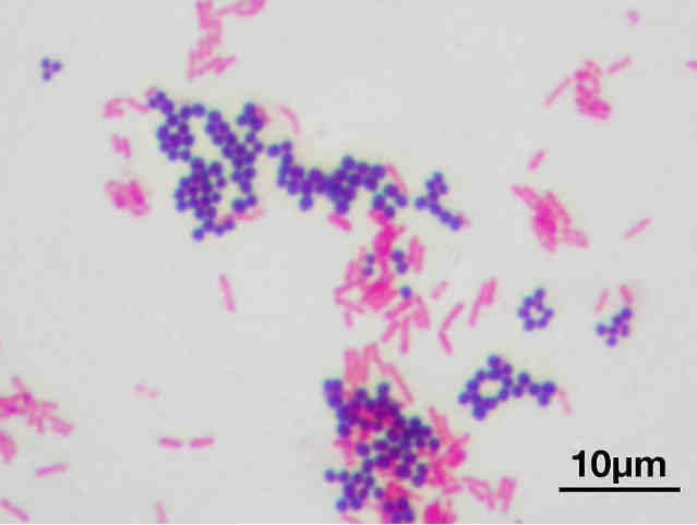 Staphylococcus aureus — золотистый стафилококк