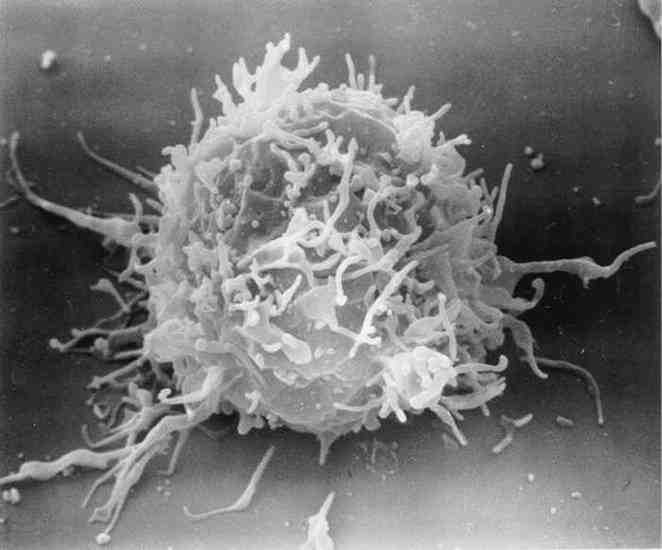 Изображение ВИЧ