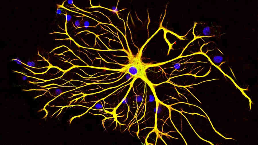 Нейроны головного мозга Нейроны головного мозга