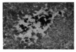 Одна из рентгенограмм Солнца.